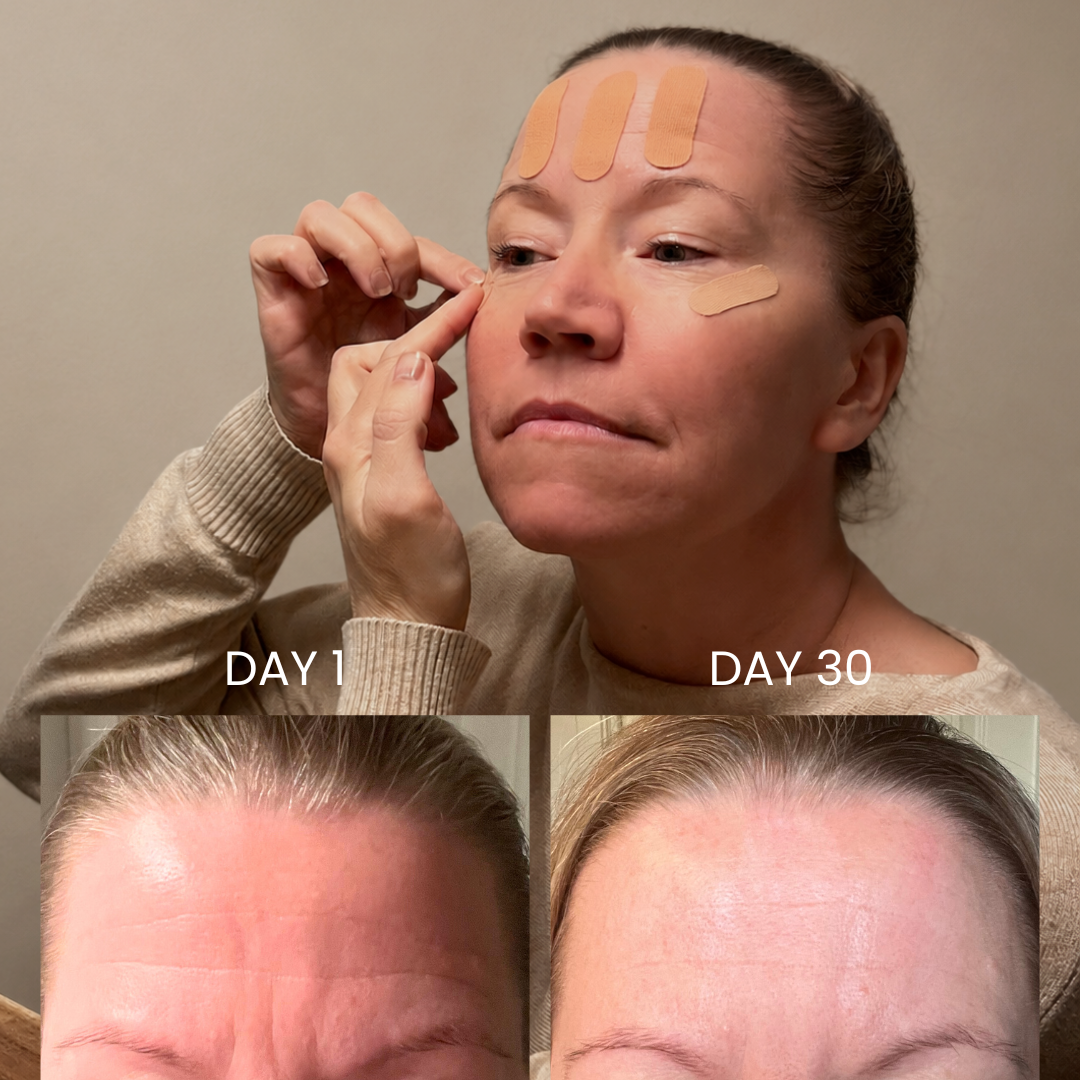 Before and after comparison of a woman's face with HOLLI face tape on different days, showing skin improvement.